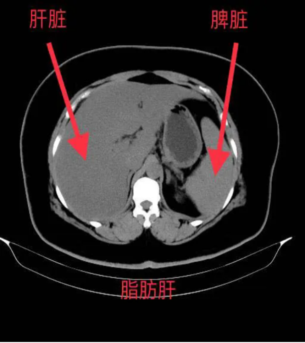 圖片2.png